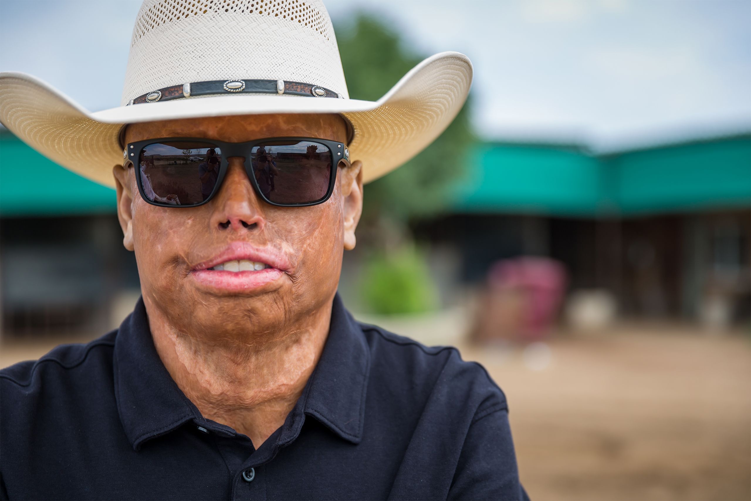 Burn Center General Development Fund